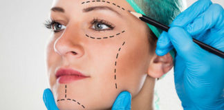 ¿Qué debe tener en cuenta a la hora hacerse un procedimiento estético?